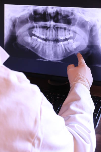 Best Emergency Tooth Extraction in Atlanta, IL