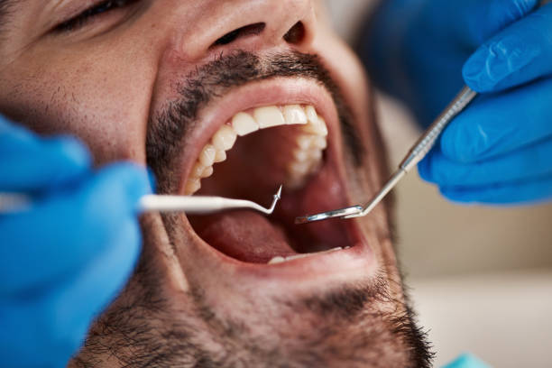 Best Emergency Root Canal Treatment in Atlanta, IL